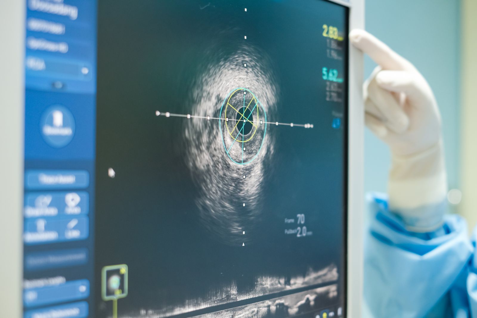 IQVIA Holdings' Q2 2026 Earnings: What to Expect